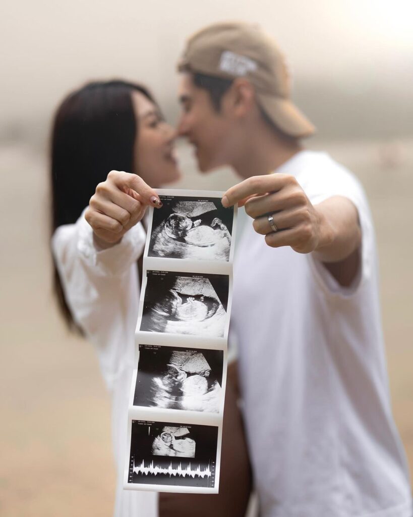 Carlos Chan and Shiga Lin announce pregnancy, carlos chan, celeb asia, shiga lin, theHive.Asia